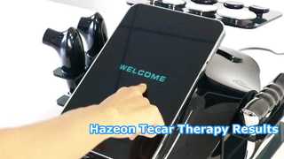 RL-W20 Hazeon Tecar 치료기 - 고급 448kHz 물리치료 및 재활 장치