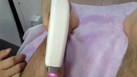 경쟁력 있는 가격 808nm 다이오드 레이저 탈모 기계 1-50A 에너지와 1-400ms 펄스 너비